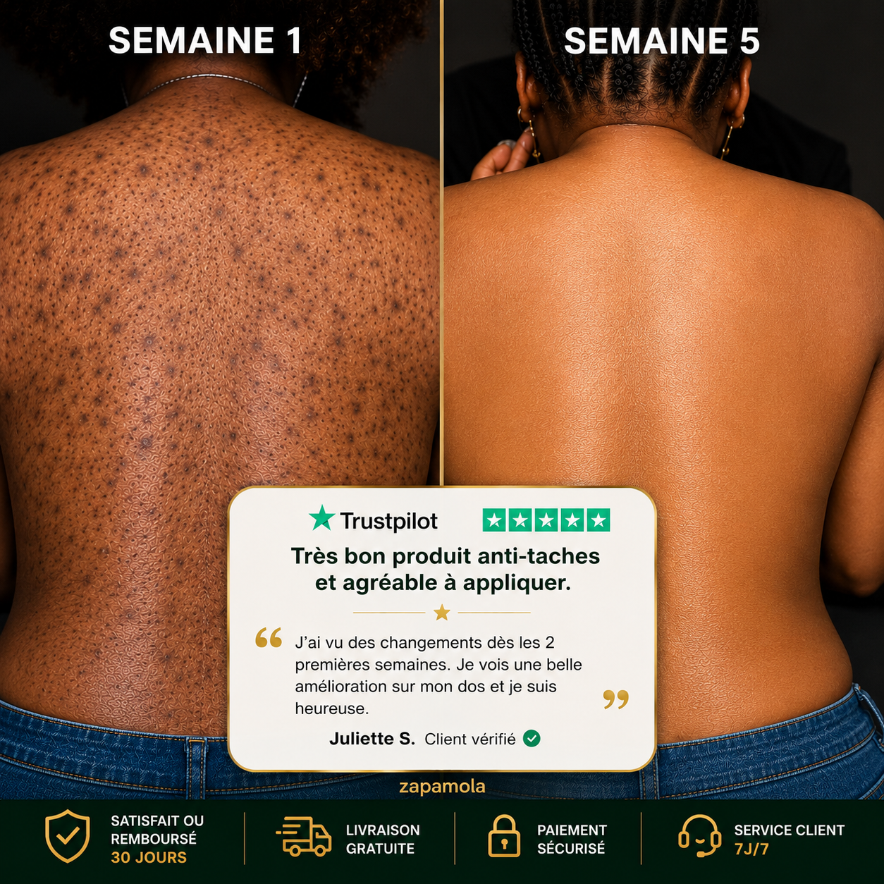 Crème Correctrice Anti-Taches Corps  (Hyperpigmentation - Tous types de Peaux )