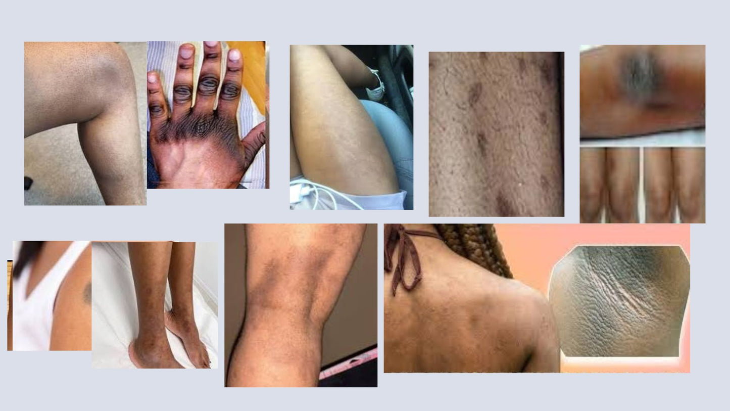 ZAPAMOLA- Crème Illuminatrice & Anti-Taches et Hyperpigmentation - Tous types de Peaux