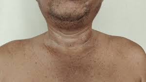 ZAPAMOLA- Crème Illuminatrice & Anti-Taches et Hyperpigmentation - Tous types de Peaux