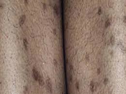 ZAPAMOLA- Crème Illuminatrice & Anti-Taches et Hyperpigmentation - Tous types de Peaux